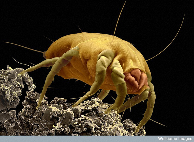 Dust Mite